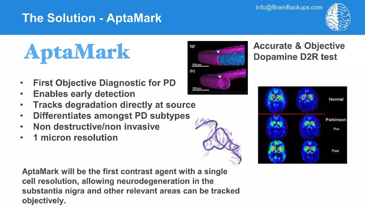 Brain Backups pitch deck slide 4 of 18