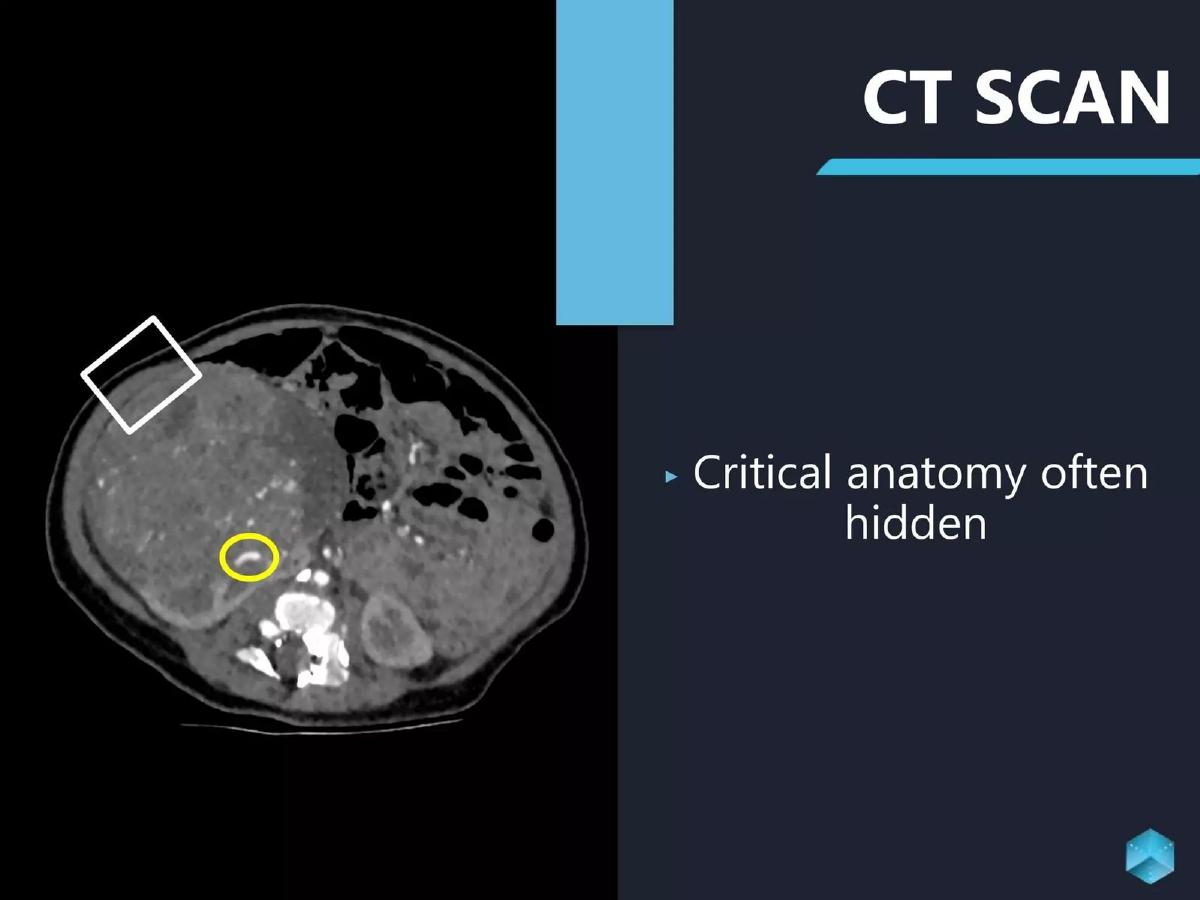 Sira Medical pitch deck slide 2 of 36