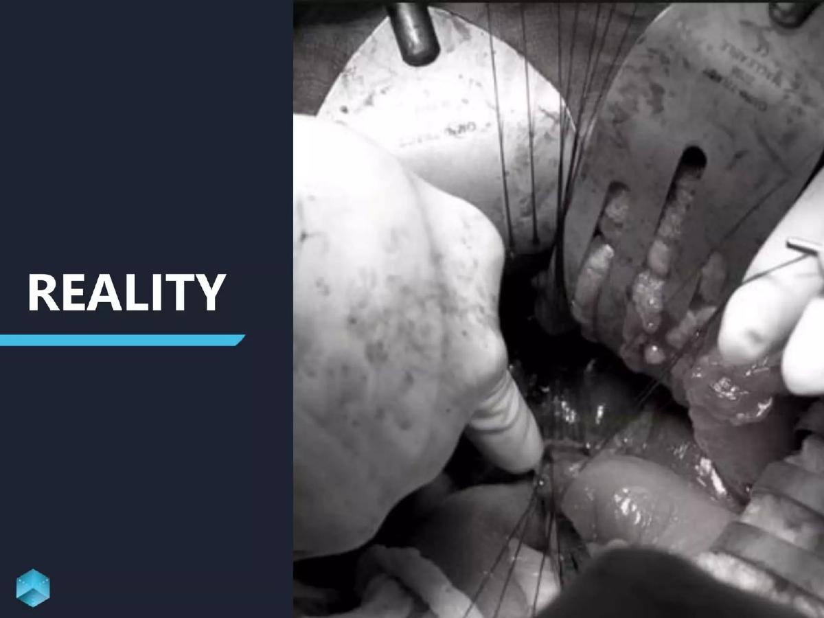 Sira Medical pitch deck slide 3 of 36